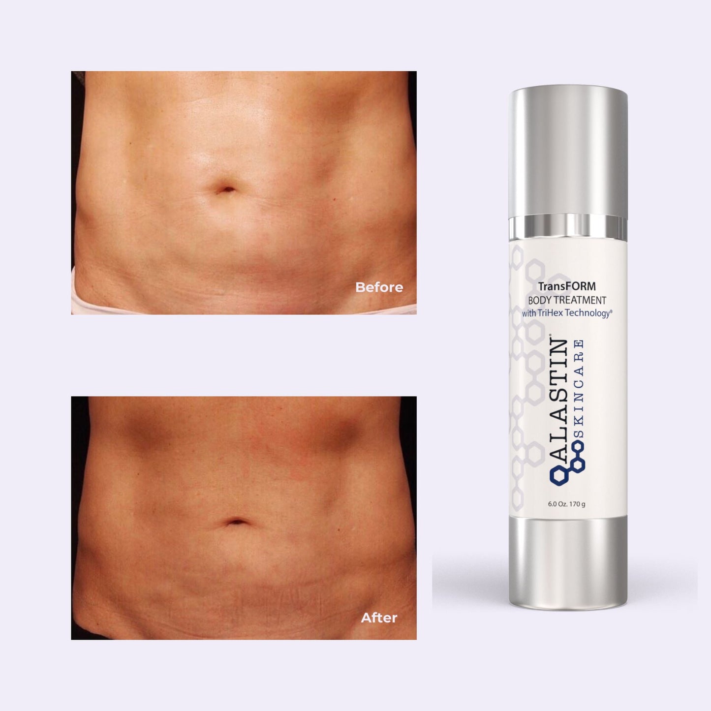 TransFORM Body Treatment