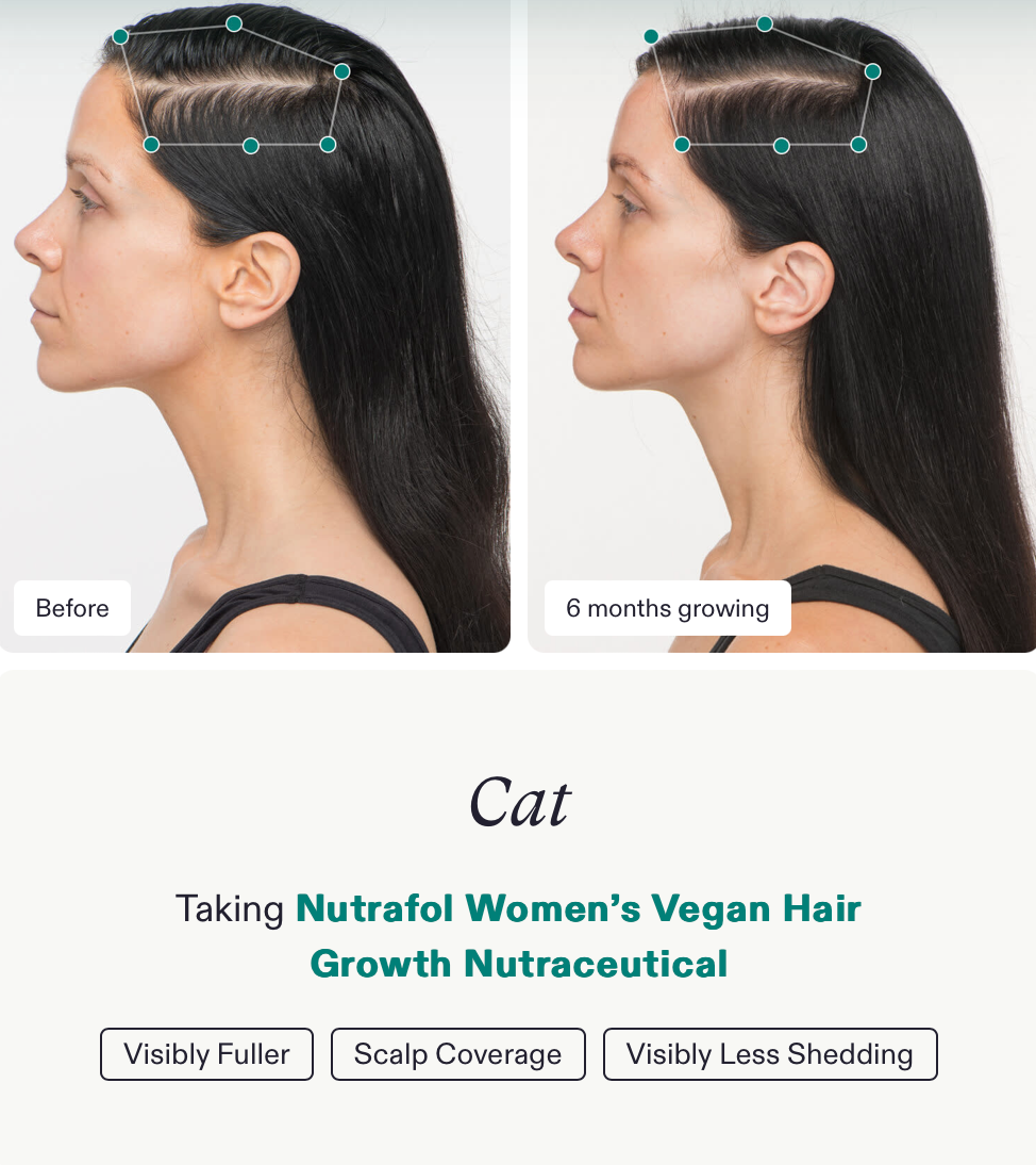 Nutrafol Hair Growth Nutraceutical - 3 month supply