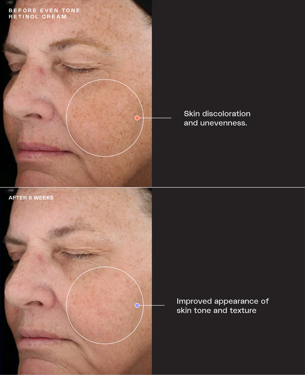 Even Tone Retinol Cream